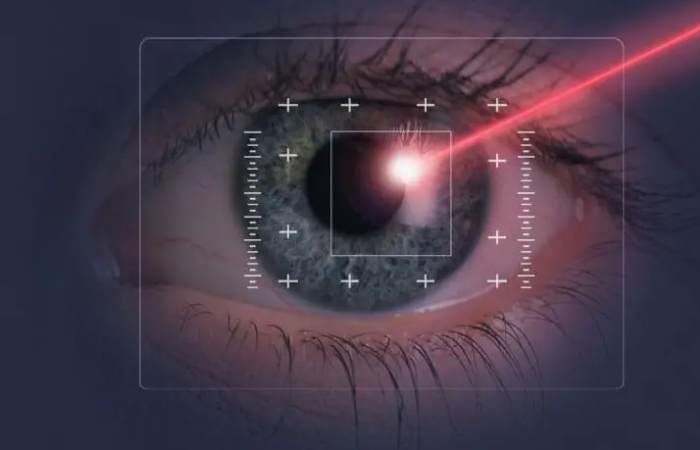 LASIK surgery write for us